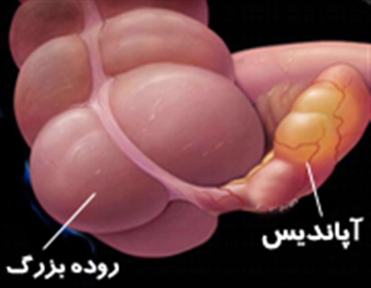 آپاندیسیت