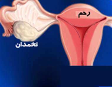 درد قاعدگی، رحم، تخمدان