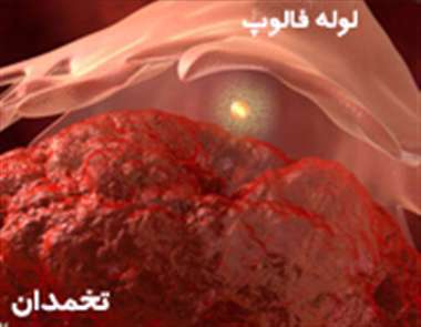 لوله فالوپ، تخمدان