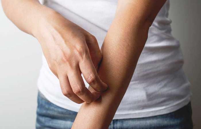 حس راه رفتن حشره روی پوست فورمیکاسیون، حس راه رفتن حشره روی پوست،