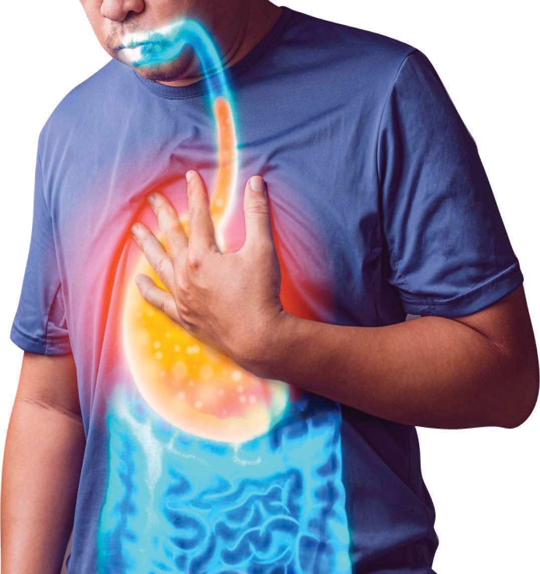 8 راهکار خانگی برای بهبود ریفلاکس اسیدی 8 راهکار خانگی برای بهبود ریفلاکس اسیدی