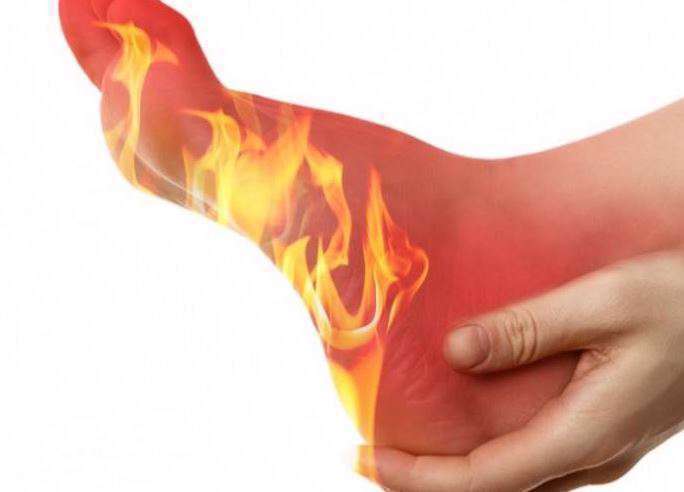 داغ شدن و سوزش پاها