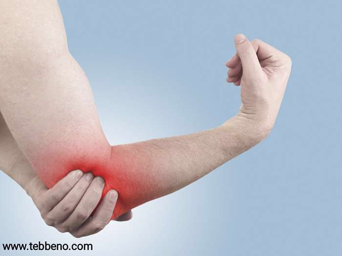 طب سوزنی و فیزیوتراپی در منزل توسط مرکز طب نو