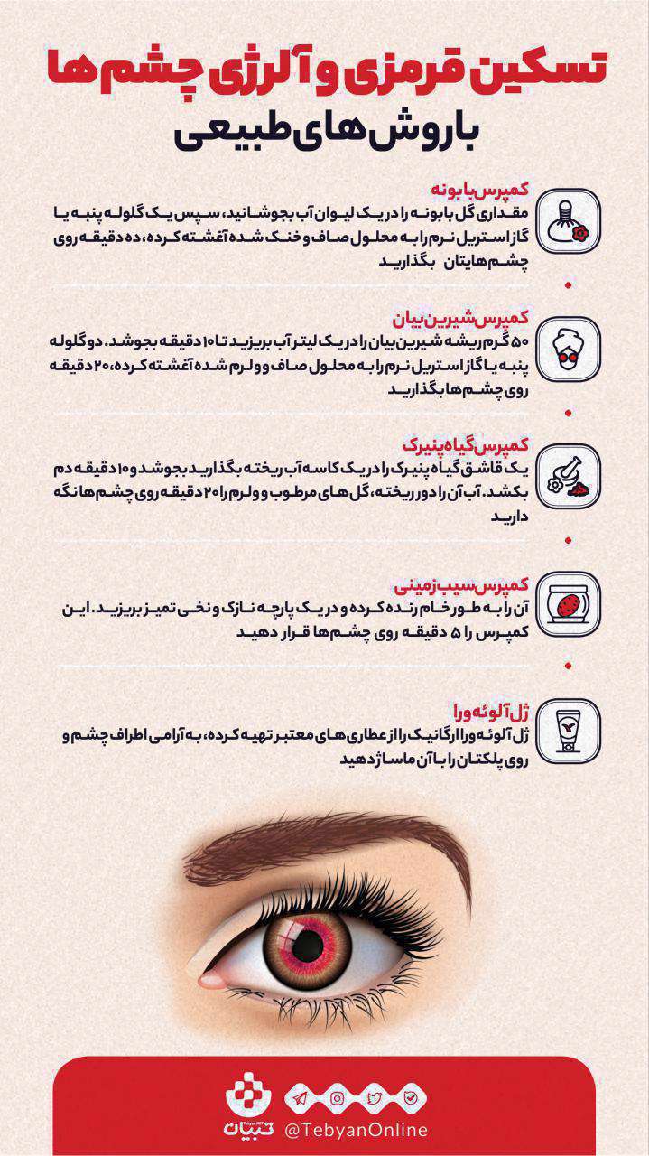 تسکین قرمزی چشم و آلرژی چشم ها با روش های طبیعی؛ اینفوگرافیک تسکین قرمزی چشم و آلرژی چشم ها با روش های طبیعی؛ اینفوگرافیک