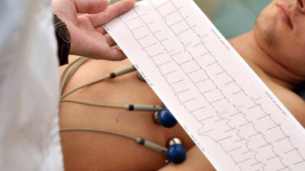 بیماران قلبی - آزمایش بیماری قلبی - الکتروکاردیوگرام- ekg