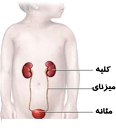 عفونت ادراری کودک