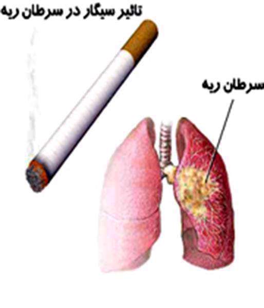 سیگار و سرطان ریه