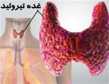غده تیروئید