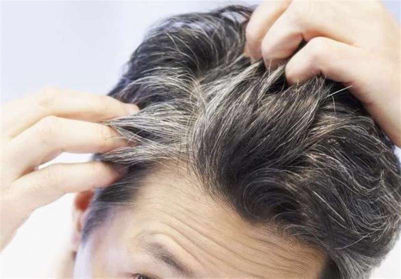 سفید شدن مو - سلامت مو - موهای سر