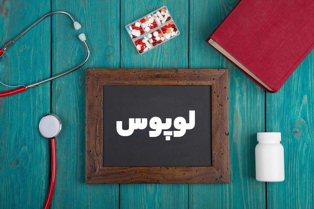 لوپوس