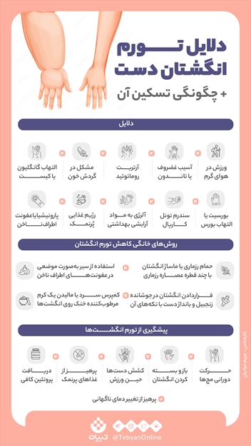 دلایل تورم انگشتان دست + چگونگی تسکین آن