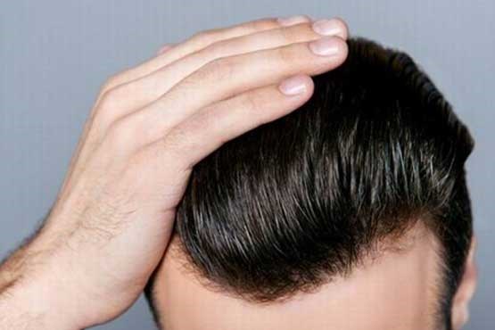 بیماری و موها، سلامتی و موها، بیماری و موها، سلامتی و موها،