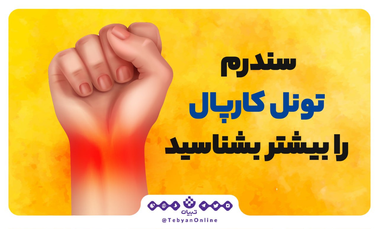 سندرم تونل کارپال را بیشتر بشناسید سندرم تونل کارپال را بیشتر بشناسید