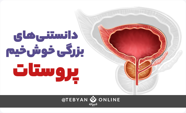 دانستنیهای بزرگی خوشخیم پروستات دانستنیهای بزرگی خوشخیم پروستات