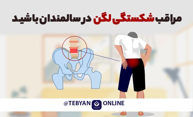 مراقب شکستگی لگن در سالمندان باشید مراقب شکستگی لگن در سالمندان باشید