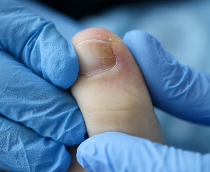 ناخن‌های شما از سلامتیتان چه می‌گویند؟