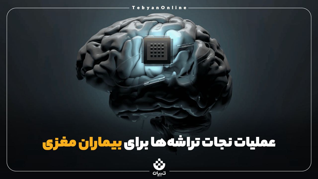 علم پزشکی ، ایمپلنت مغزی، بیماران مغزی، عملیات نجات تراشهها، علم پزشکی ، ایمپلنت مغزی، بیماران مغزی، عملیات نجات تراشهها،