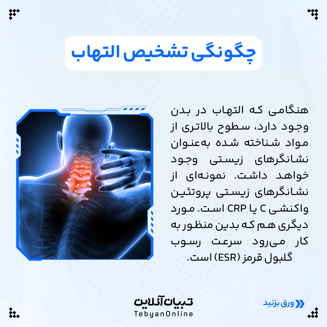 التهاب ، التهاب در بدن ، تسکین التهاب ، کنترل التهاب ، انواع التهاب، التهاب حاد، التهاب مزمن،  تشخیص التهاب ،