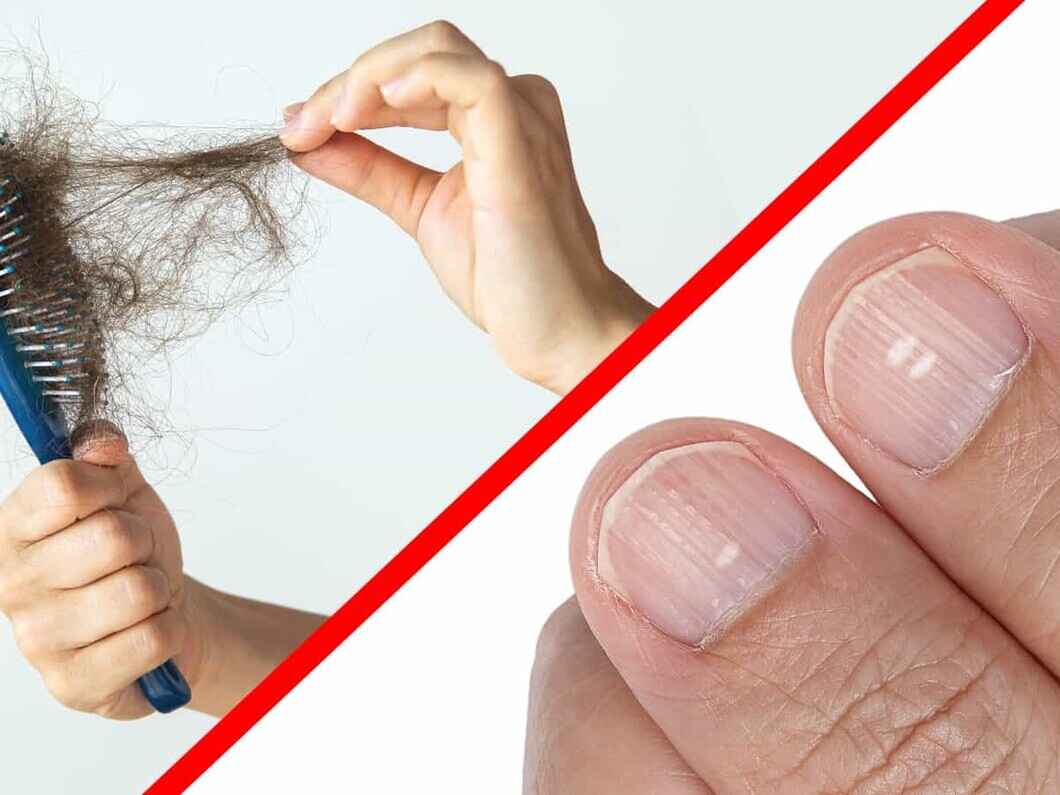 علائم کمبود موادمغذی