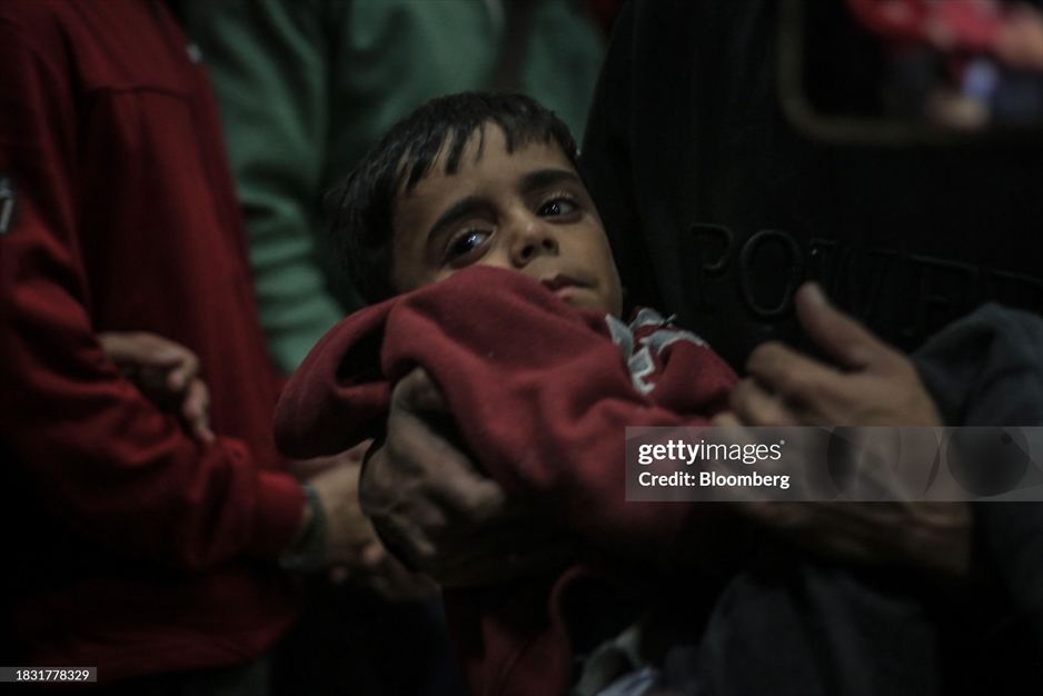 زخمی شدن مردم غزه از حملات رژیم صهیونیستی