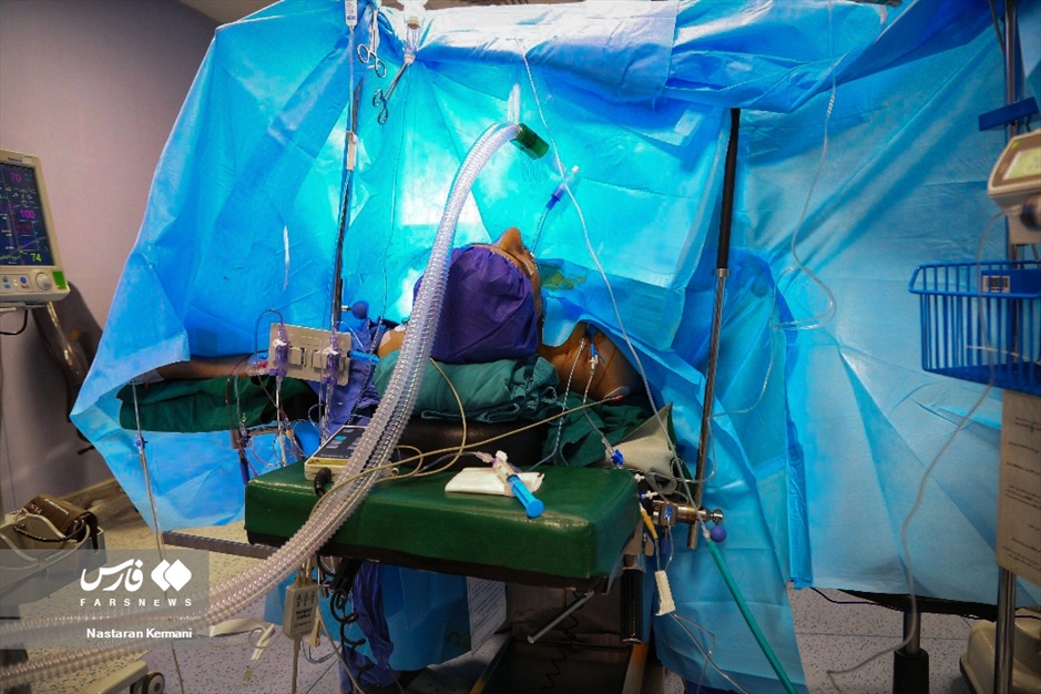 عمل قلب باز در البرز