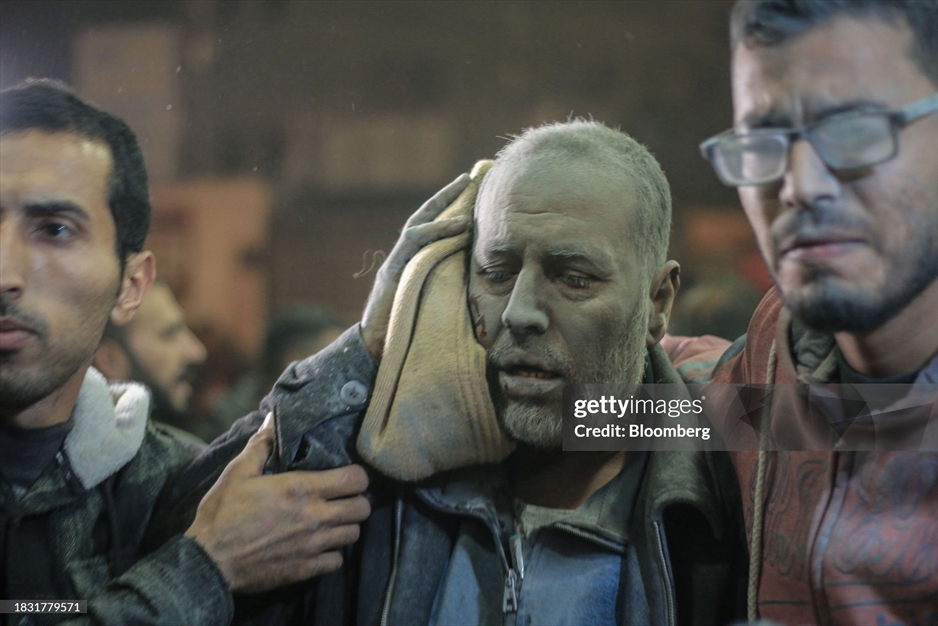 زخمی شدن مردم غزه از حملات رژیم صهیونیستی