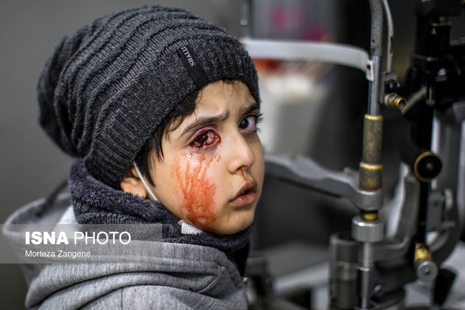 مصدومان چهارشنبه‌سوری - تهران