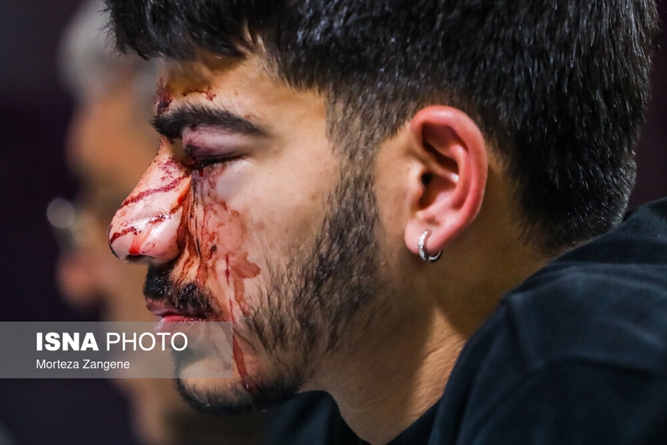 مصدومان چهارشنبه‌سوری - تهران