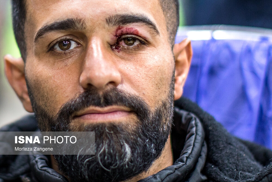 مصدومان چهارشنبه‌سوری - تهران