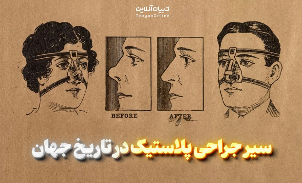 سیر جراحی‌ پلاستیک در تاریخ جهان