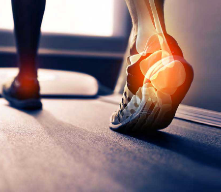 پاشنه‌تان چرا درد می‌کند و چه باید بکنید؟ 